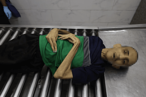 Gazze’de Açlık Krizi Derinleşiyor: Son 24 Saatte 10 Kişi Hayatını Kaybetti